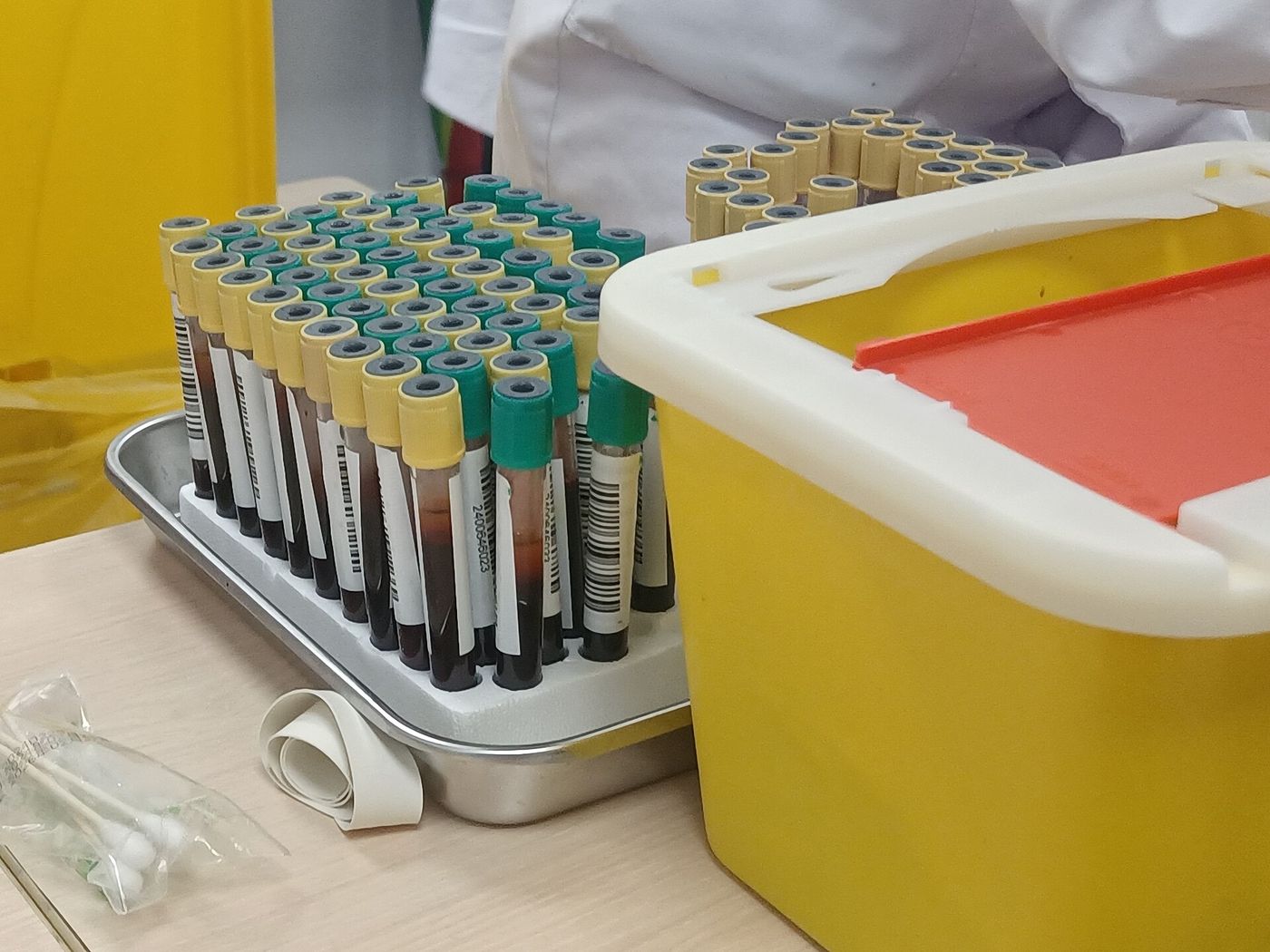 Blood test samples